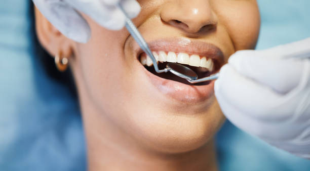 Best Broken or Chipped Tooth Repair in Hollister, MO